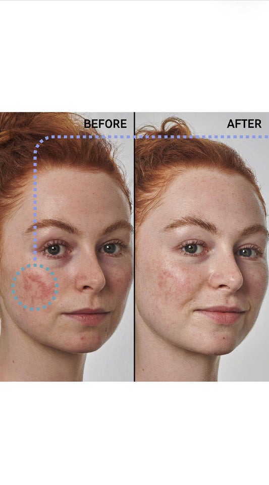 THE INKEY LIST
SuperSolutions+ 10% Azelaic Acid Serum