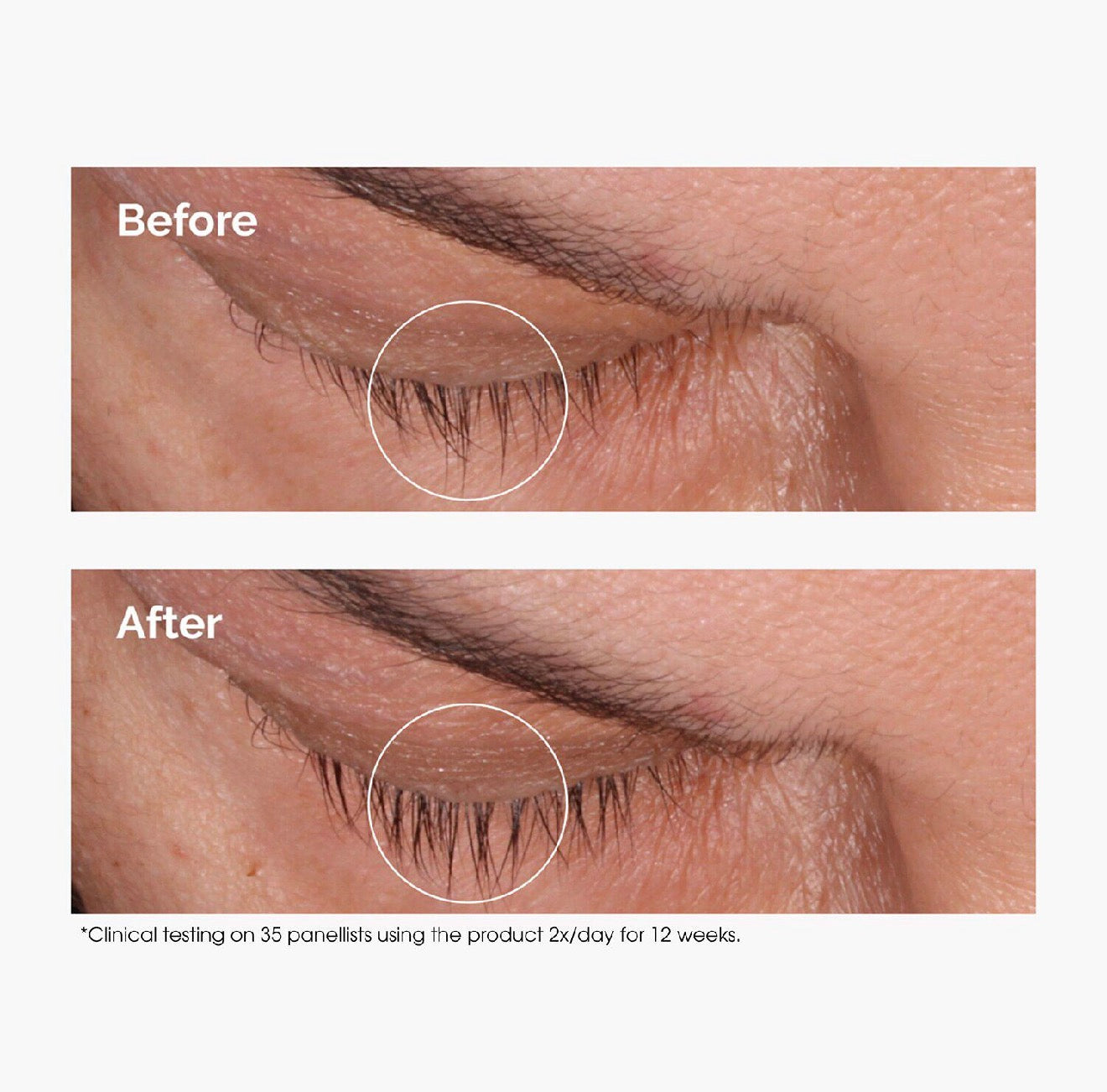 THE ORDINARY
Multi-Peptide Lash and Brow Serum