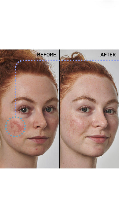 THE INKEY LIST
SuperSolutions+ 10% Azelaic Acid Serum